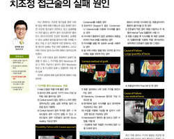 치과전문지 덴탈아리랑에 임플란트 수술법에 대해 연재